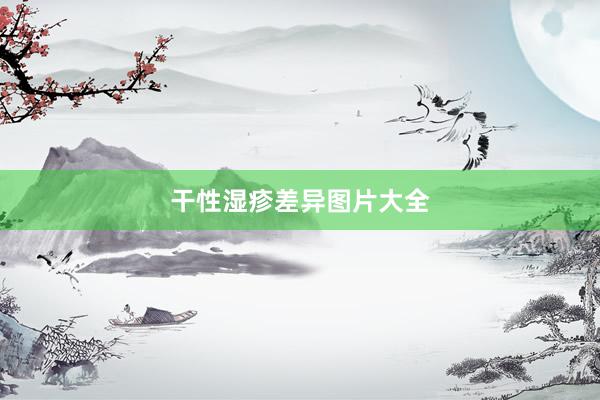 干性湿疹差异图片大全